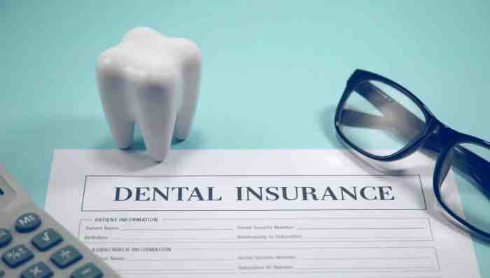 Dental Insurance Plans: What’s Actually Covered